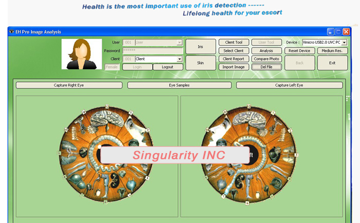 3 in 1 Iriscope+Skin Analyzer+Hair Analyzer,5.0MP High Resolution