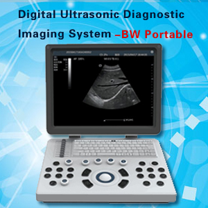 Hot selling BW Portable Digital UItrasonic Diagnostic Imaging System