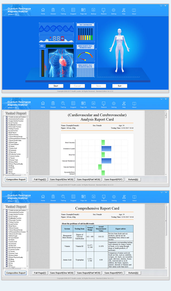 The latest Quantum resonance analyzer