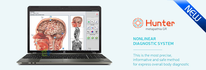 Hot!The latest Metatron-4025 Hunter with 3D spiral scanning