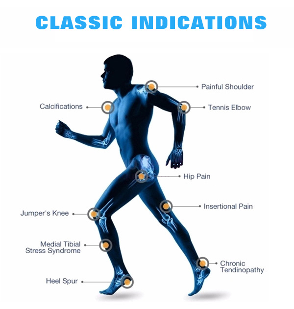 The newest Shock Wave therapy machine