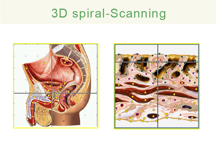 Bio resonance scan  newest device Meta-hunter