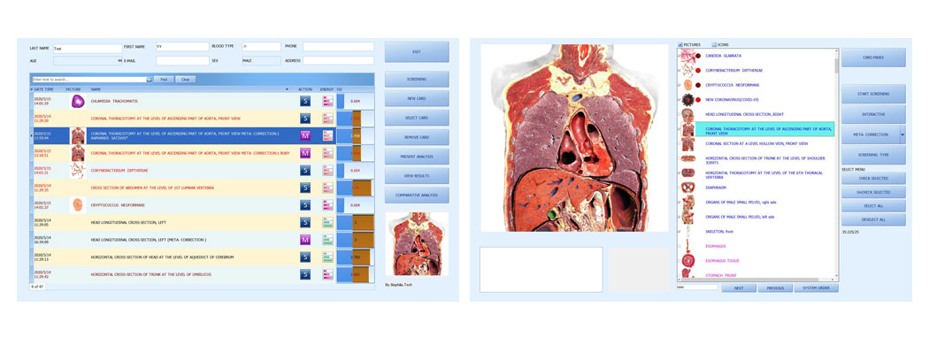 The powerful Biophilia Intruder Bioresonance Machine for Fast screening the Bacteria and Viruses